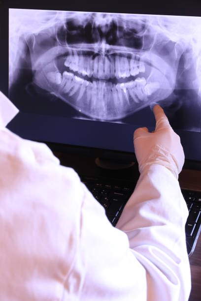 Best Emergency Wisdom Teeth Removal in Pato, WA